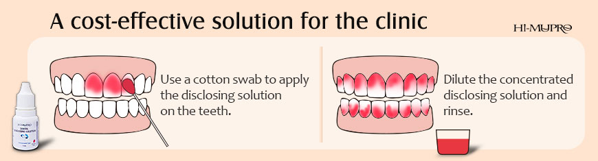 Dental Disclosing Solution