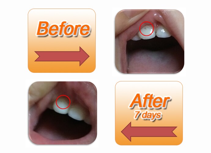 INTELLIGENT Saliva Enzymes Children Toothpaste Non Without Fluoride Swallowed Safe Remove dark spots Plaque Stains Tartar teeth