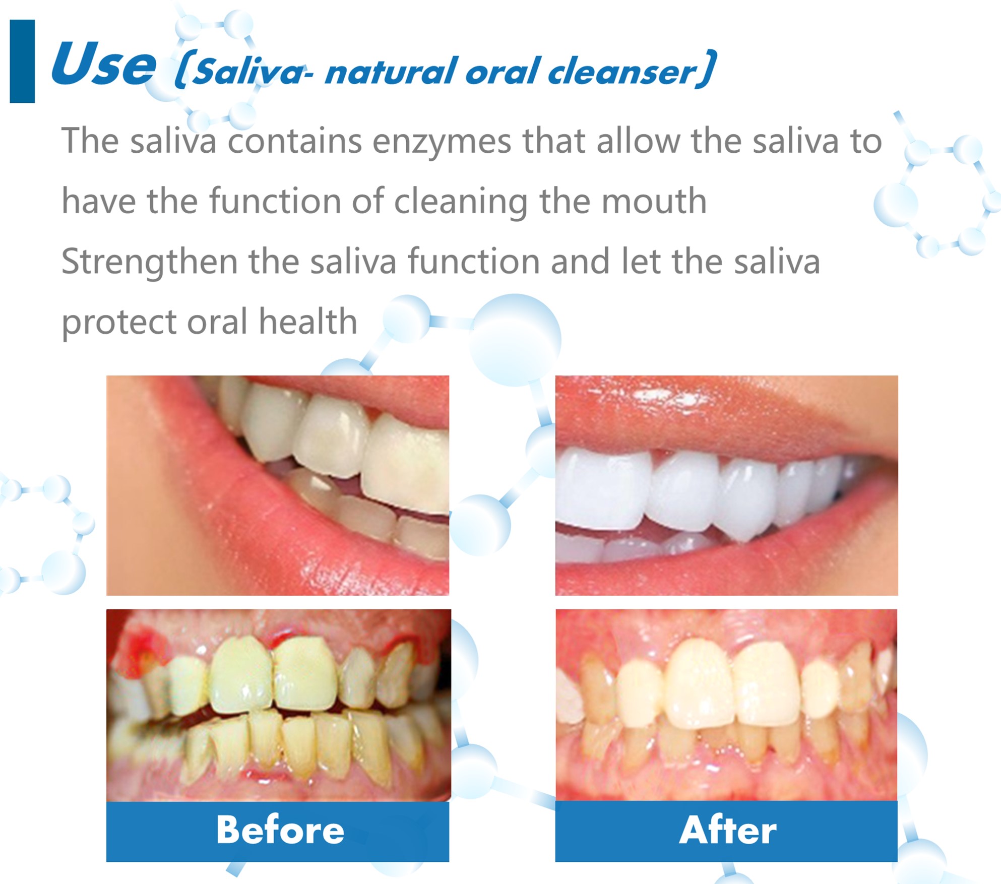 Stain removal toothpaste fluoride free and teeth whitening toothpaste