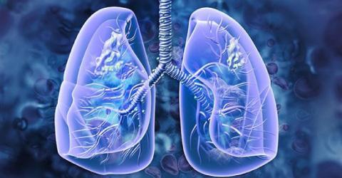 Early detection programme finds majority of lung cancer at initial phases