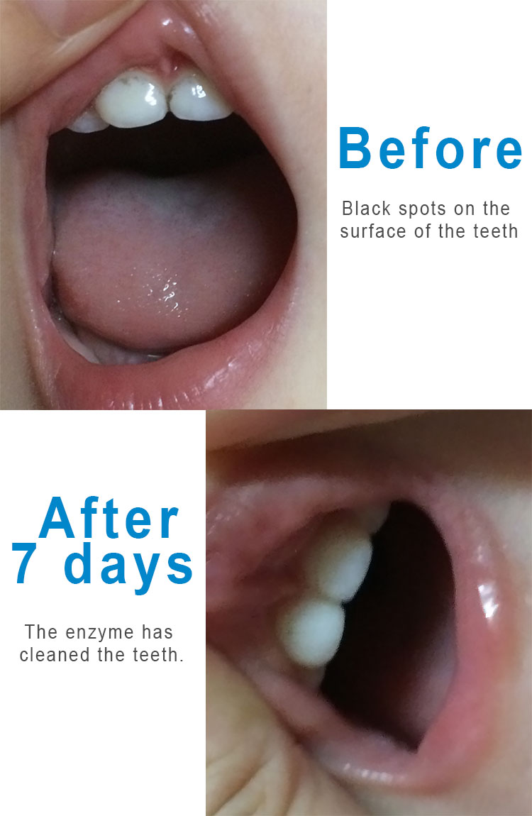 INTELLIGENT Saliva Enzymes Baby Toothbrush Natural Chewable Soft Silicone Innovative 6 Stage Oral Care Brands For First Teeth