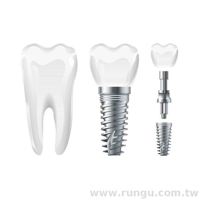 Drive dental implant turning parts supplier Taiwantrade