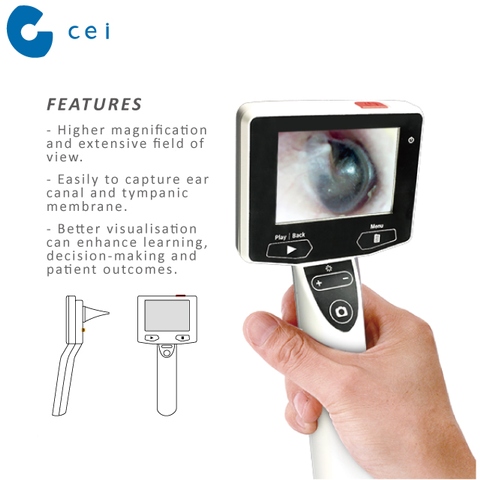 OEM and ODM Portable Digital Otoscope Camera