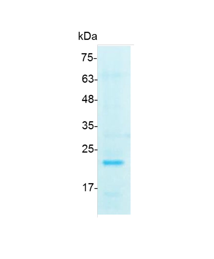 FGF 3 Fibroblast Growth Factor 3 Human Taiwantrade fgf-3-fibroblast-growth-factor-3-human-taiwantrade
